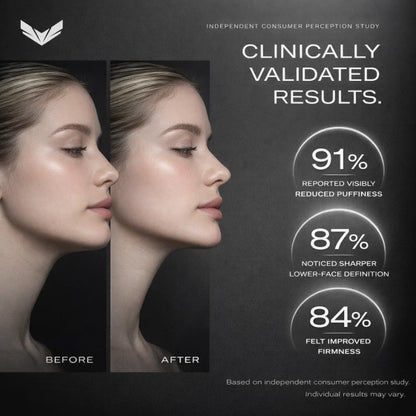 Cactox™ Snatch V-Line Mask